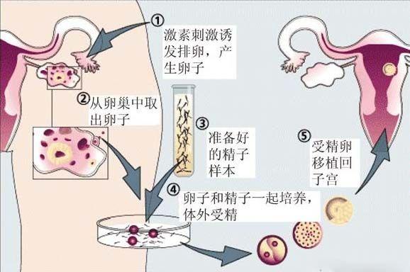 国内借卵试管代怀地址(国内借卵试管代怀地址解析及对比)